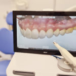 Computer screen image of digital scan of teeth.