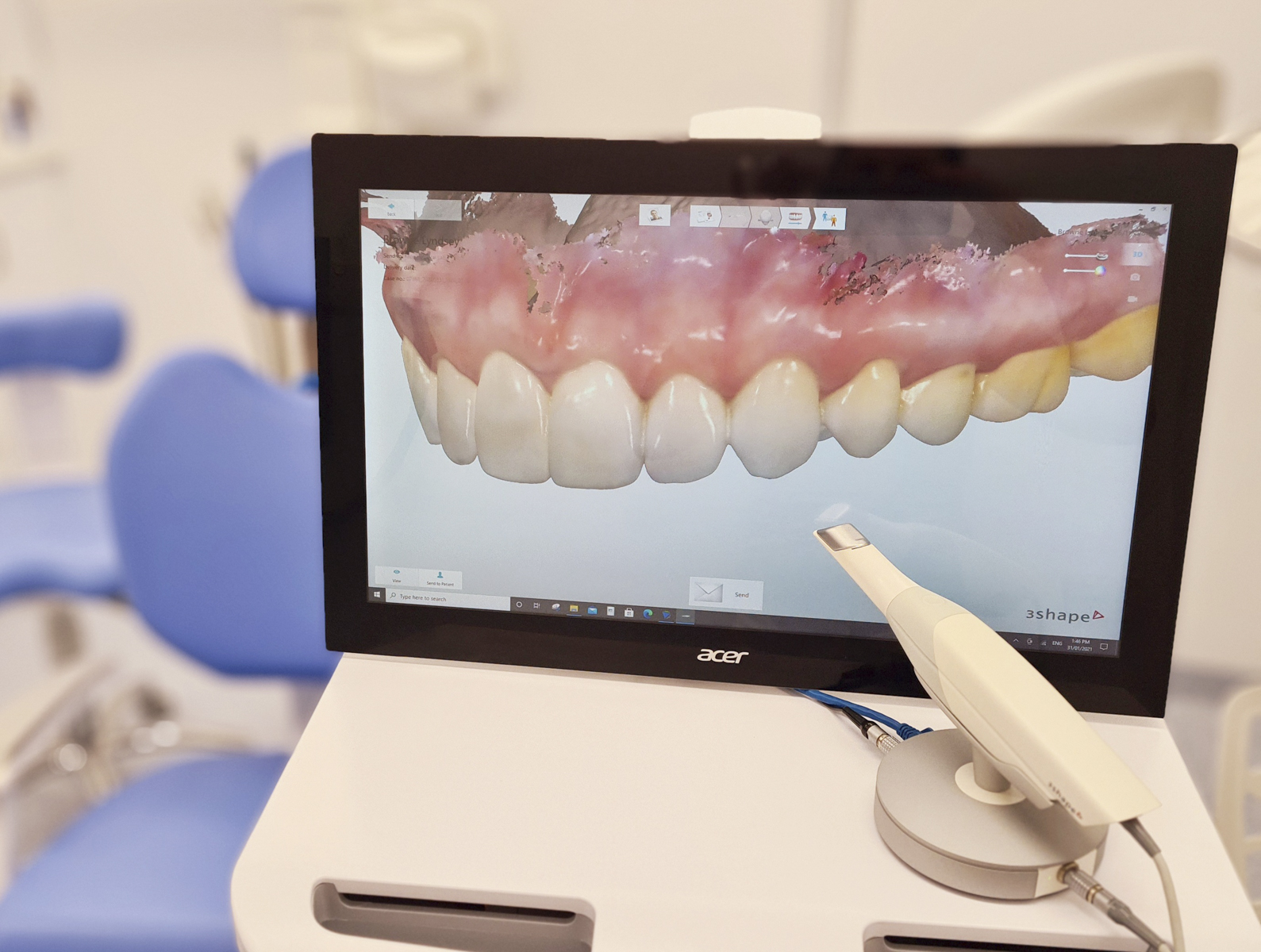 Digital Dental