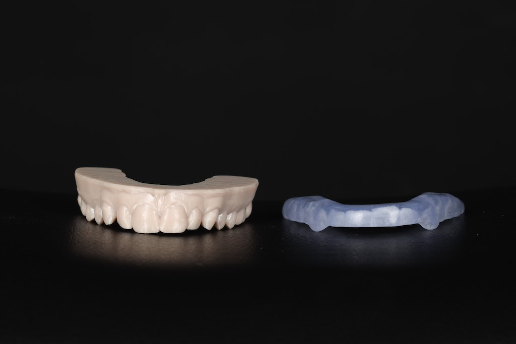 occlusal splint for teeth grinding protection sat next to a plaster model of upper teeth