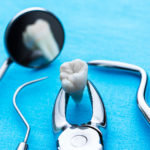 Dentistry instruments for tooth removal at the dentist.