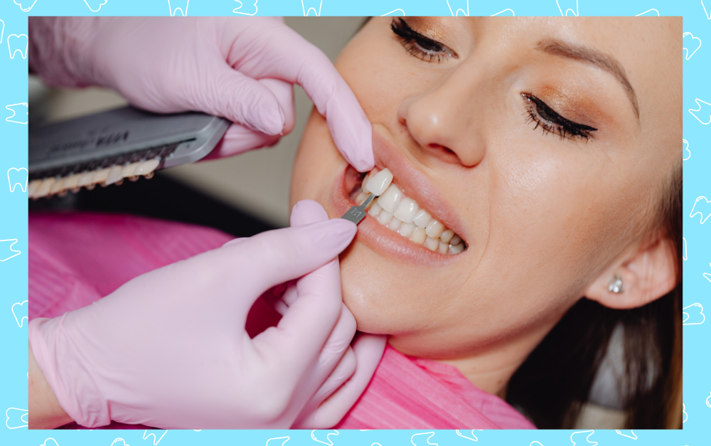 Dentist applying veneers.