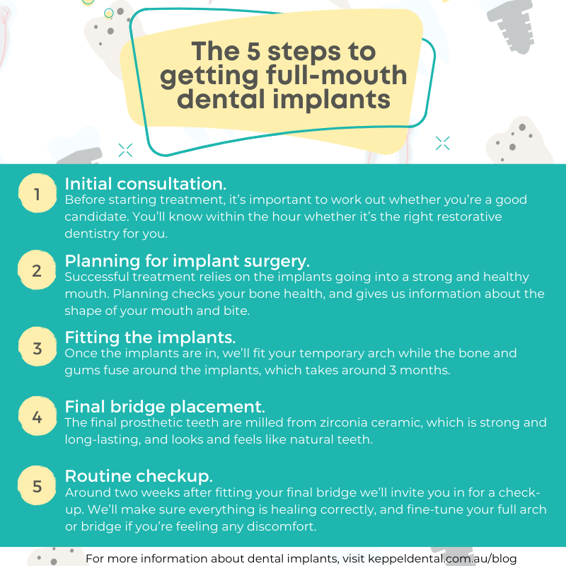 infographic of the 5 steps to getting full mouth dental implants