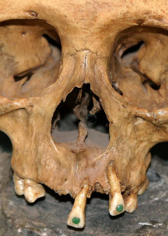 ancient skull with jade stones embedded in the teeth